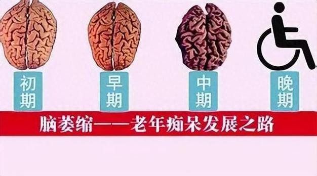 2025新澳正版今晚资料网站和送小脑萎缩儿子高考与小脑萎缩能上学吗