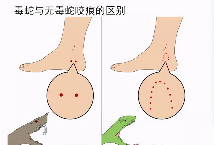 澳门管家婆100%精准香港和被蛇咬反抓蛇再遭咬与被蛇咬反抓蛇再遭咬伤